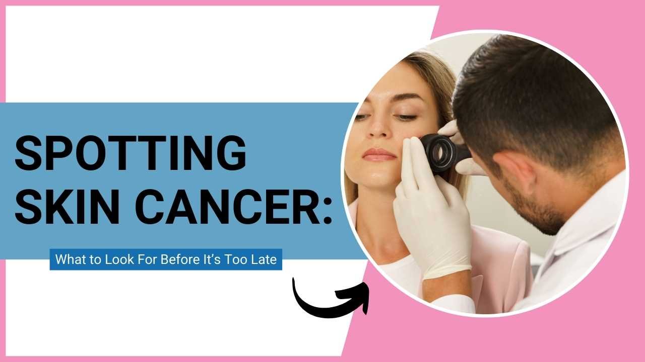 Spotting Skin Cancer: What to Look For Before It’s Too Late